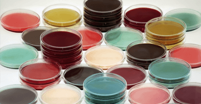 Microbiology: accredited or customized methods?