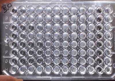 Microbiology: accredited or customized methods?